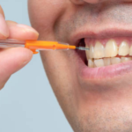 Čiščenje zob z medzobno ščetko